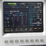 Communication service analyzer display showing frequency and modulation details.